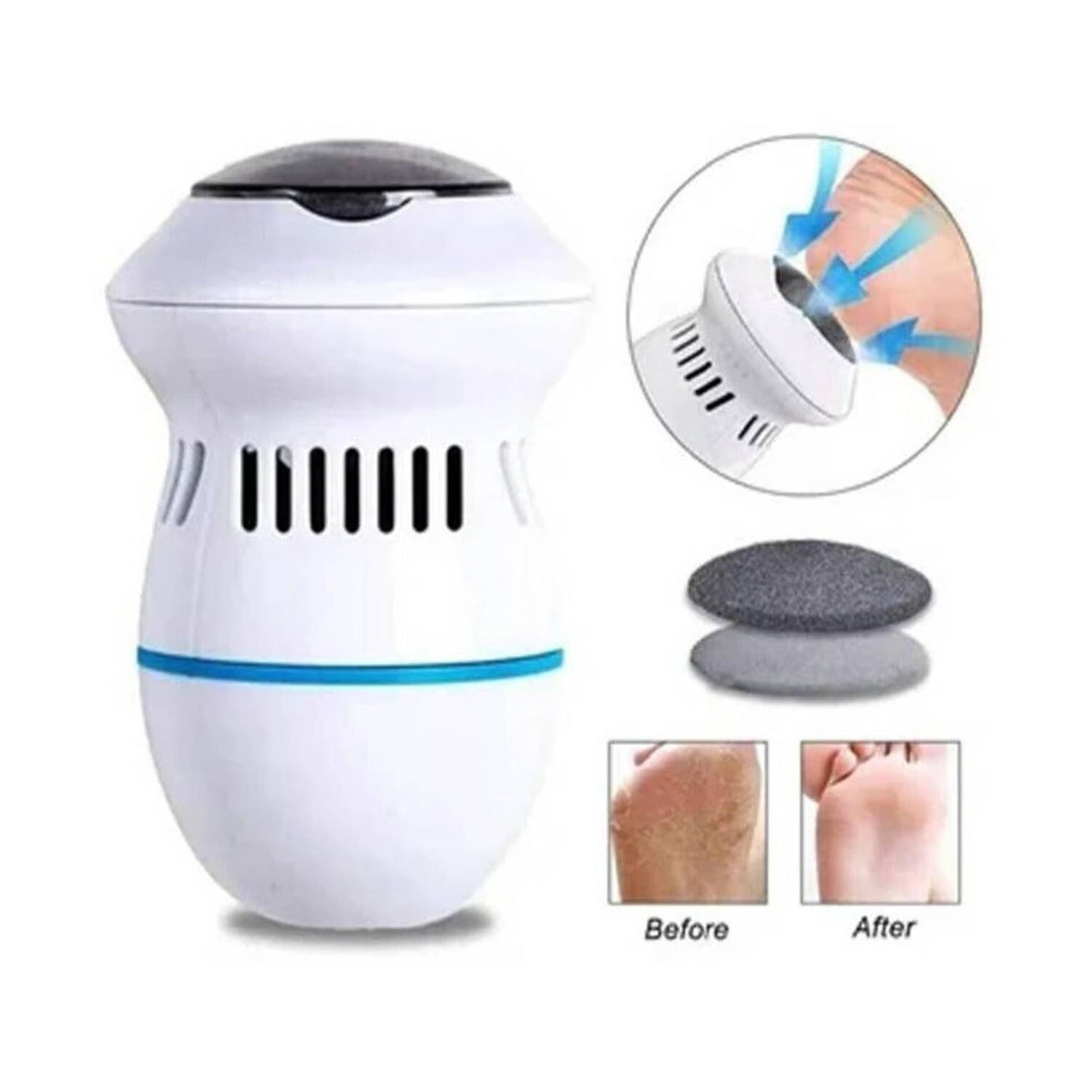 Callus remover