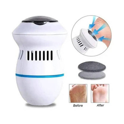 Callus remover