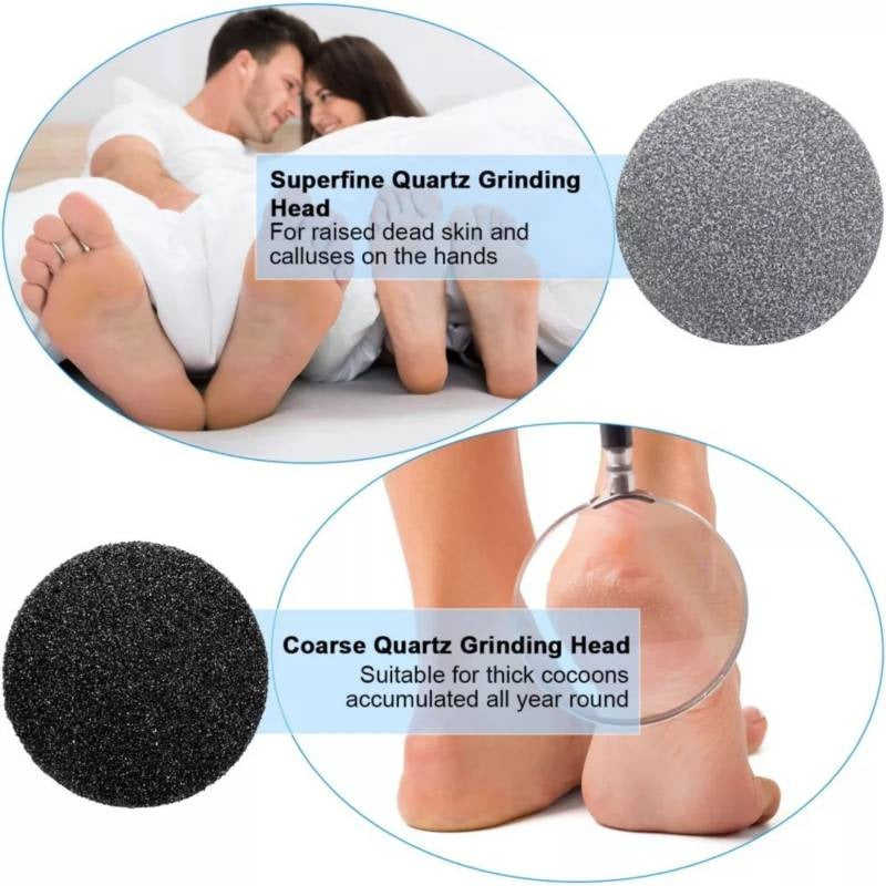 Callus remover