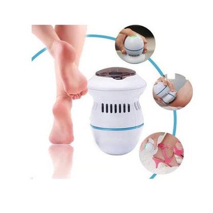 Callus remover