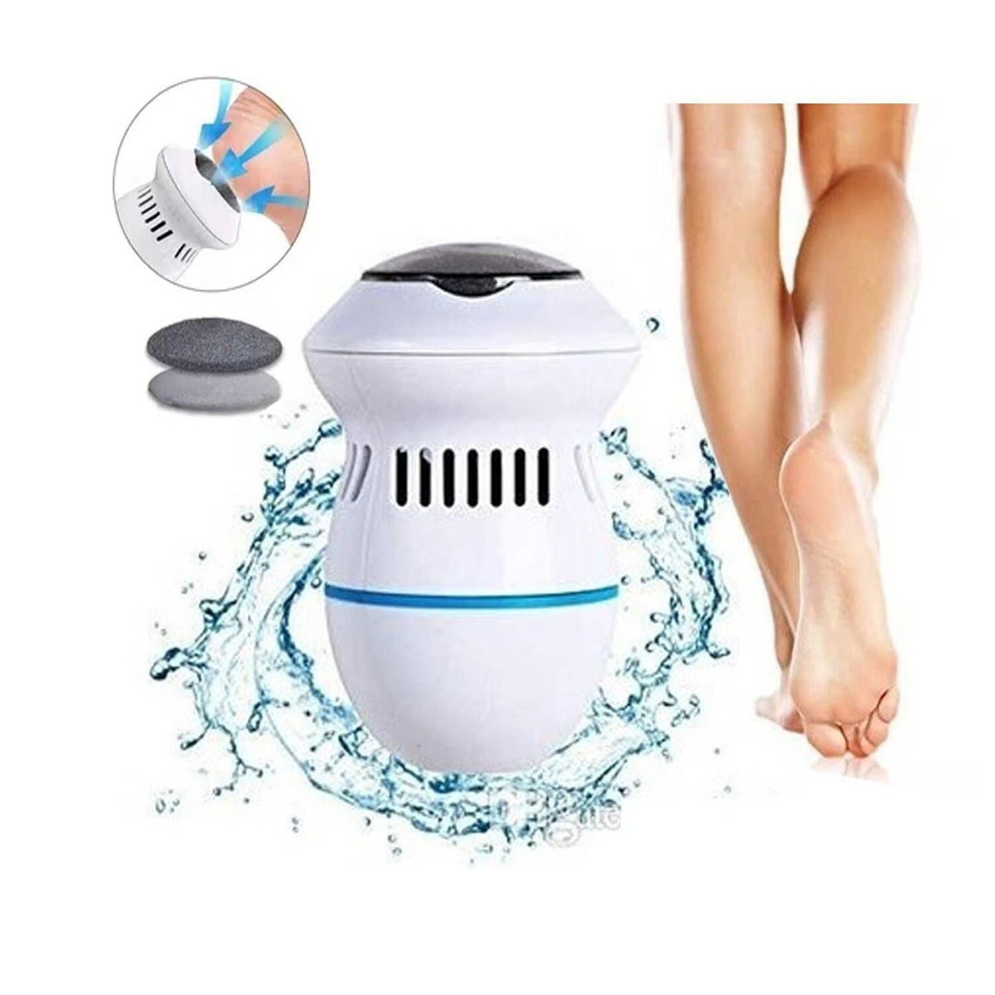 Callus remover