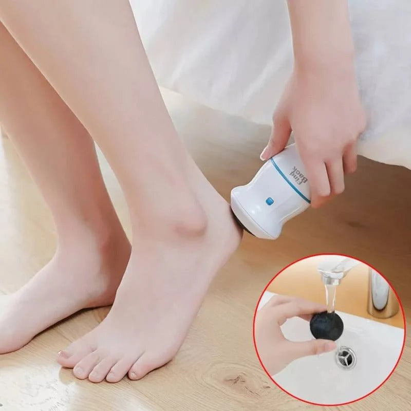 Callus remover